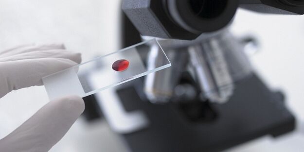 test sanguin pour diagnostiquer les parasites dans le corps