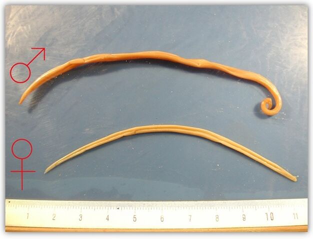 à quoi ressemblent les nématodes