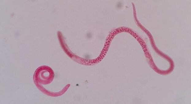 à quoi ressemblent les trichines